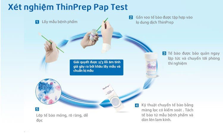 Sàng lọc ung thư cổ tử cung bằng phương pháp Thinprep