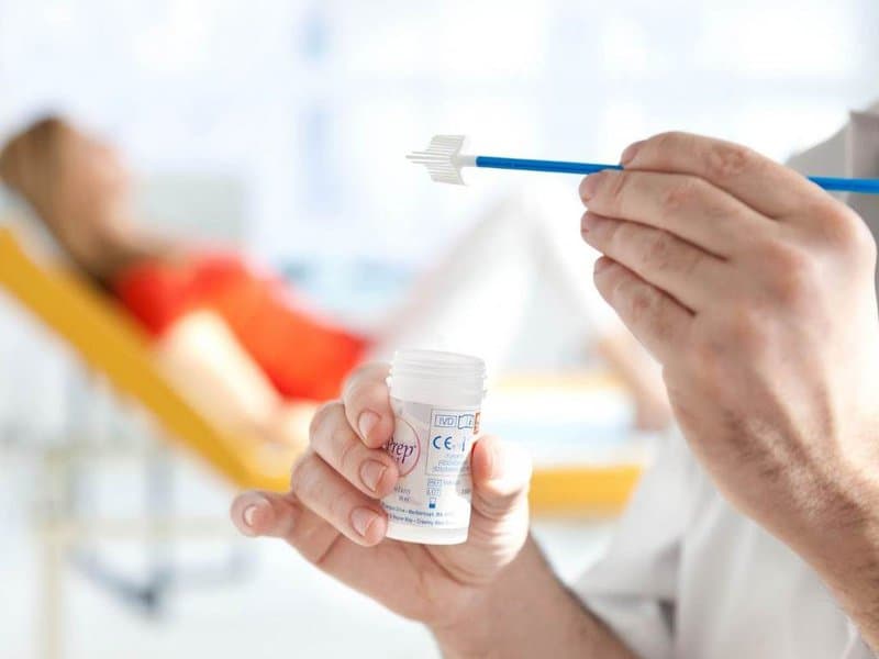 Những lưu ý trước khi thực hiện xét nghiệm Pap Smears