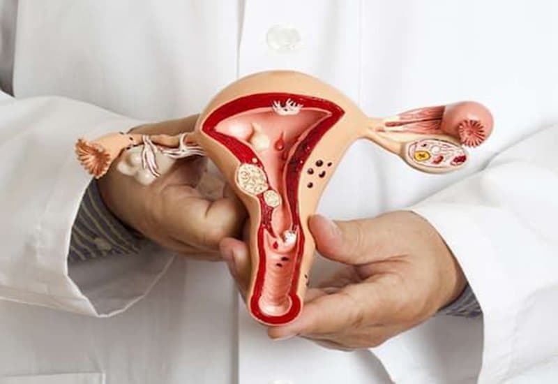 Ứ dịch vòi trứng: Nguyên nhân, triệu chứng và cách điều trị