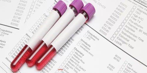 Anti HBe là gì? Chỉ số Anti HBe có ý nghĩa gì trong xét nghiệm viêm gan B?