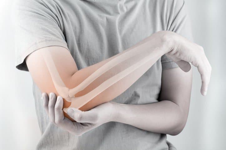 Kỹ thuật chụp X-quang cánh tay thẳng nghiêng:Chuẩn bị, quy trình và Đánh giá kết quả