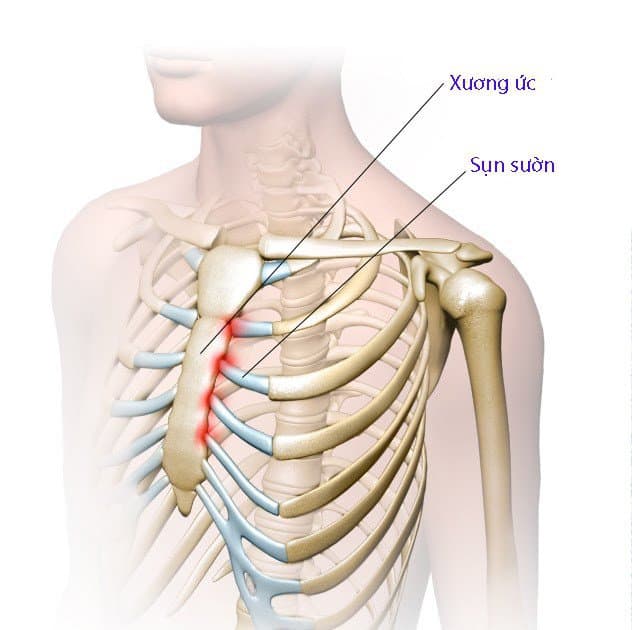 Chụp x quang xương khớp ức đòn là gì? Chuẩn bị, Quy trình chụp và Đánh giá kết quả