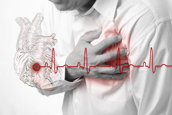 Các bước Xử trí cấp cứu ở người có bệnh lý tim mạch