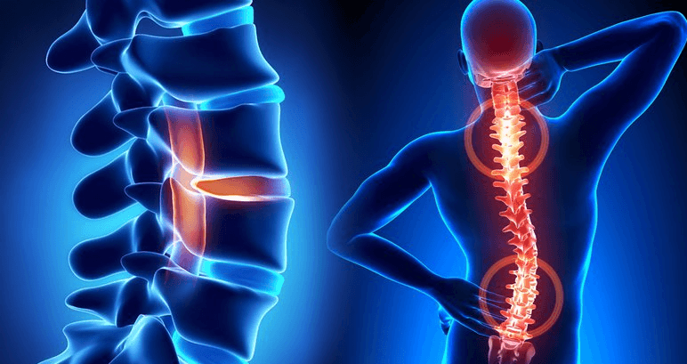 Hướng dẫn Quy trình chụp CT cột sống ngực không tiêm thuốc cản quang
