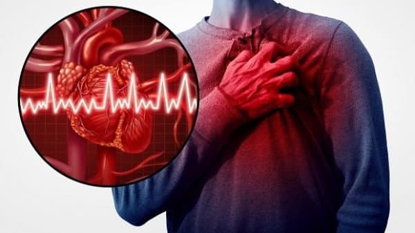 Phục hồi chức năng cho bệnh nhân sau phẫu thuật tim