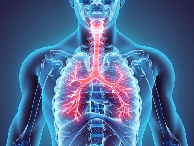 Những yếu tố nguy cơ gây của bệnh ung thư phổi