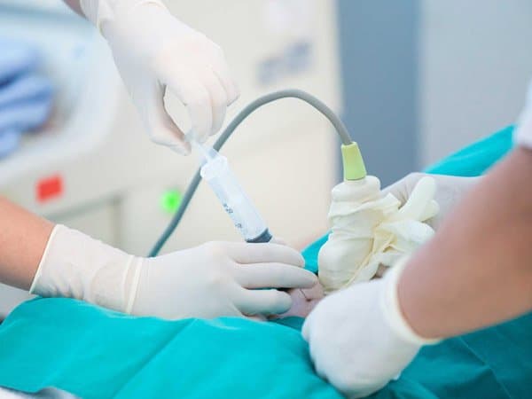 Chọc ối dưới hướng dẫn của siêu âm