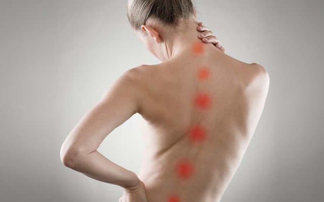 Phục hồi chức năng cho bệnh nhân vẹo cột sống