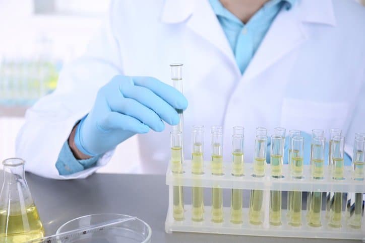 Xét nghiệm đo độ ngưng tập tiểu cầu