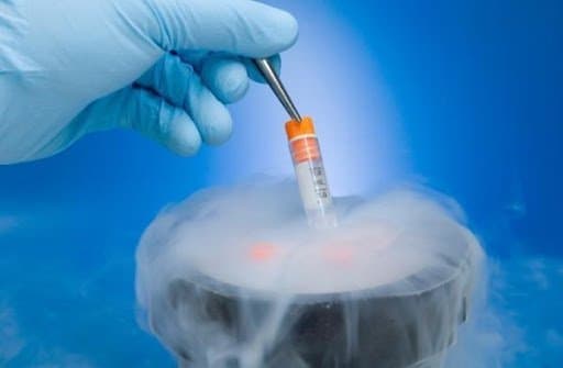 Nên chuyển phôi vào ngày thứ bao nhiêu của chu kỳ IVF?