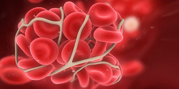 15 nơi cục máu đông có thể hình thành