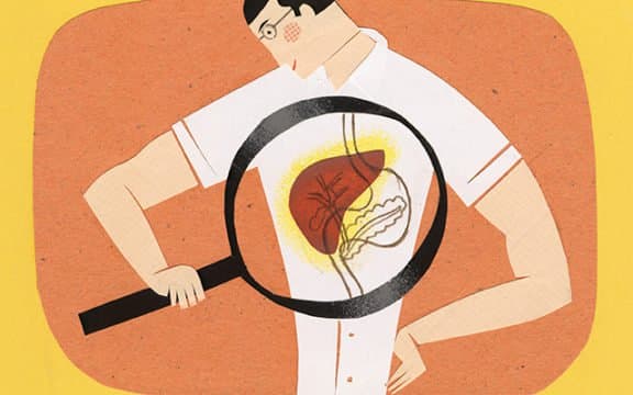 7 điều bạn có thể làm để ngăn ngừa bệnh xơ gan
