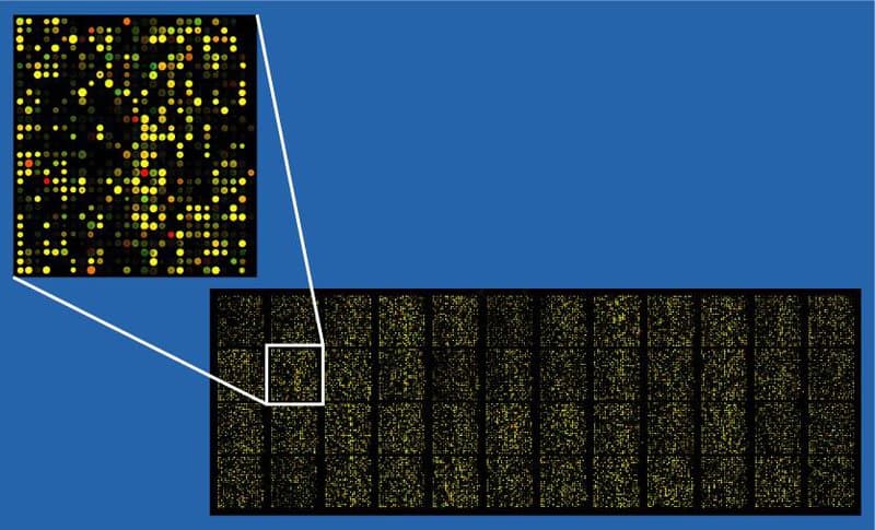 Ứng dụng của Microarray trong chẩn đoán sau sinh