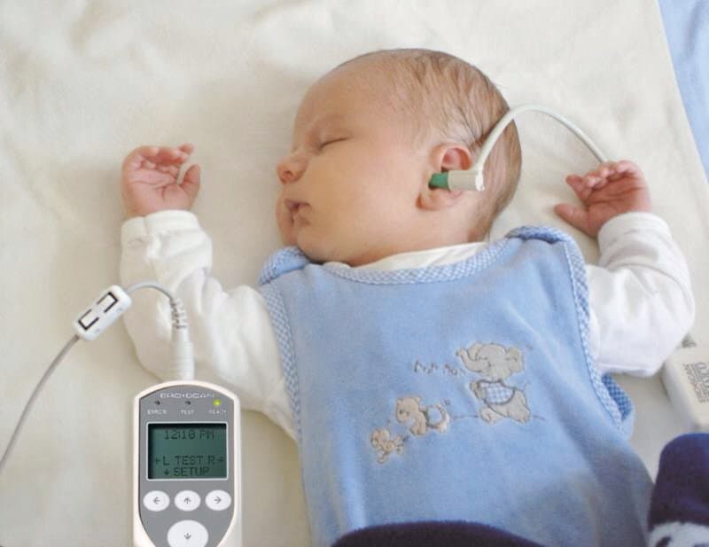 Sàng lọc mất thính lực bẩm sinh ở trẻ sơ sinh
