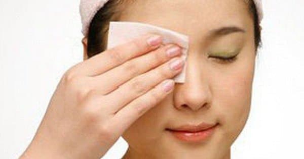 Hướng dẫn chăm sóc mắt khi bị Viêm bờ mi