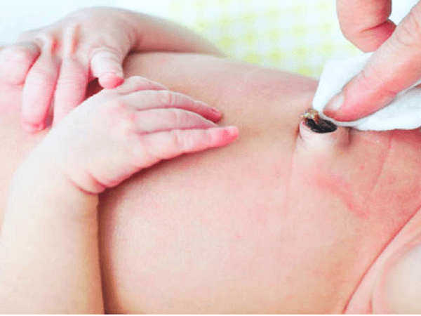 Cắt dây rốn chậm có tốt cho trẻ sơ sinh không?