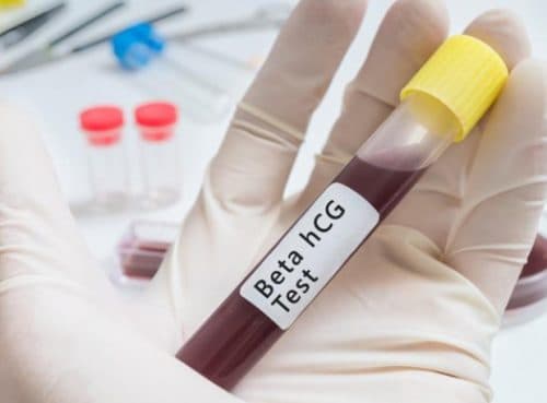 Nồng độ Beta HCG xác định tuổi thai
