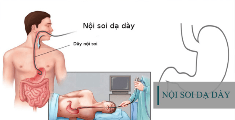 Bác sĩ nội soi dạ dày nhiều kinh nghiệm ở hà nội