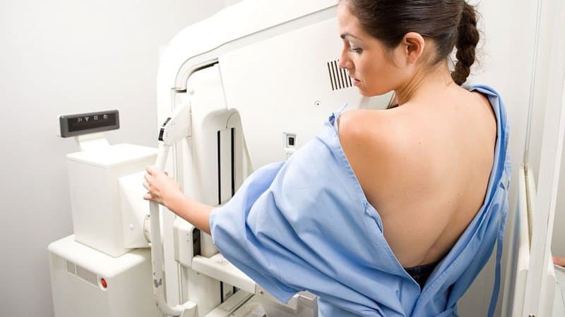 Chụp nhũ ảnh là gì? Lợi ích khi chụp nhũ ảnh