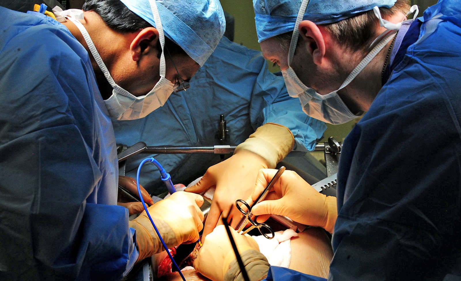 Trường hợp nào nên phẫu thuật bóc nhân xơ vú