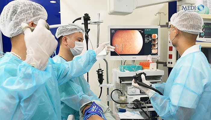 Máy nội soi dạ dày, đại tràng BL 7000 phóng đại