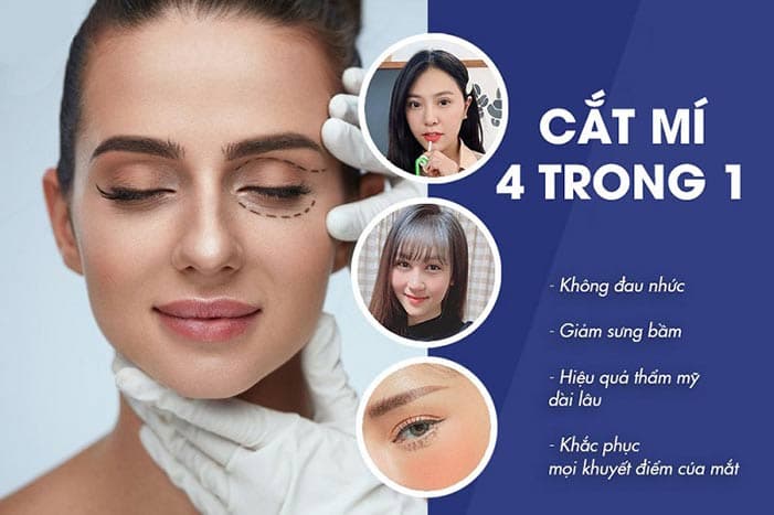 BẢNG GIÁ THẨM MỸ MẮT TẠI BỆNH VIỆN THẨM MỸ GANGWHOO