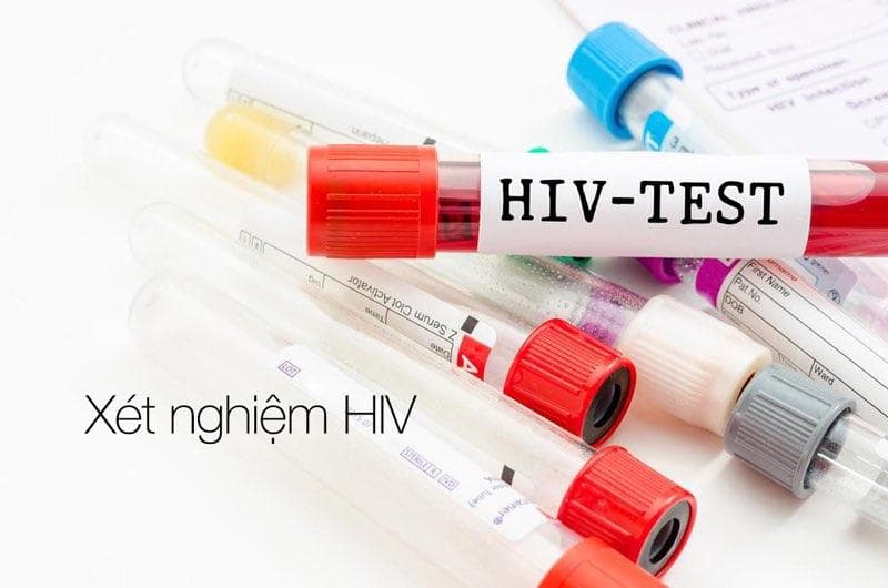 Danh sách 7 bệnh viện xét nghiệm HIV đáng tin cậy ở Hà Nội