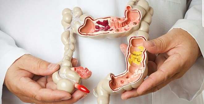 Địa chỉ khám bệnh Đại tràng hàng đầu tại TP.HCM