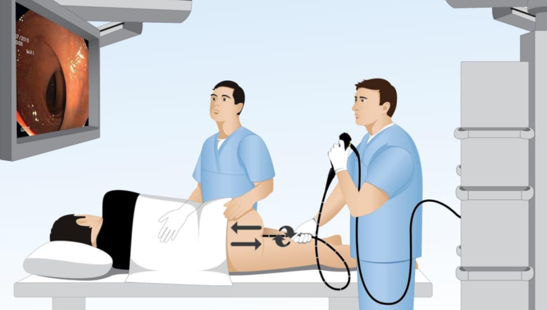 Tìm địa chỉ nội soi đại tràng uy tín tại Hà Nội ở đâu?