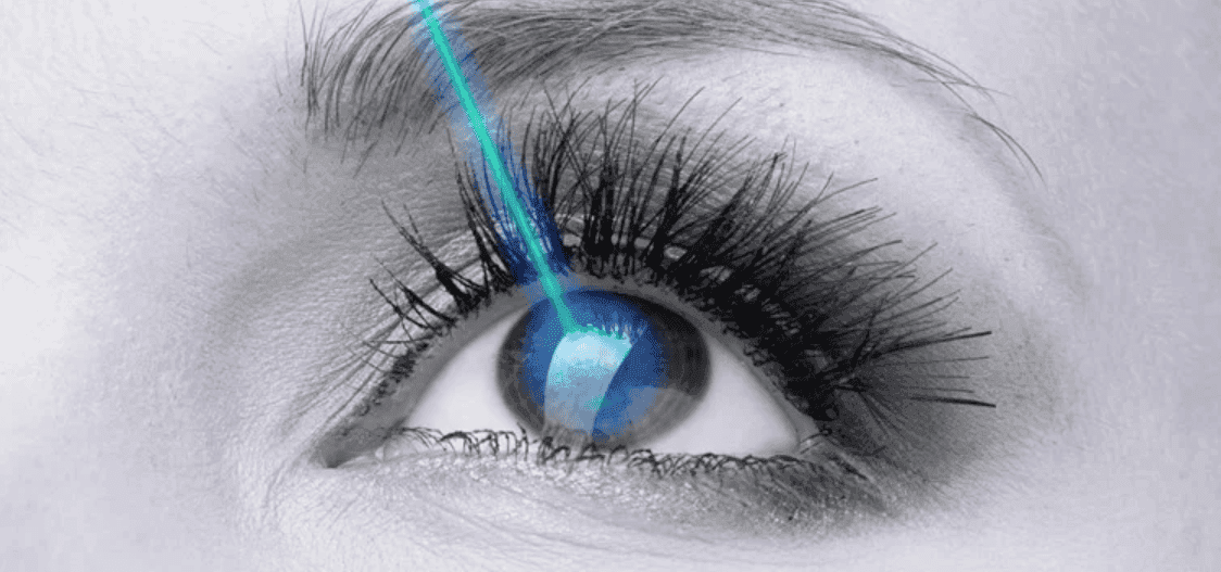 Mổ Lasik giá bao nhiêu? Xem phí mổ mắt Lasik tại 5 địa chỉ uy tín Hà Nội