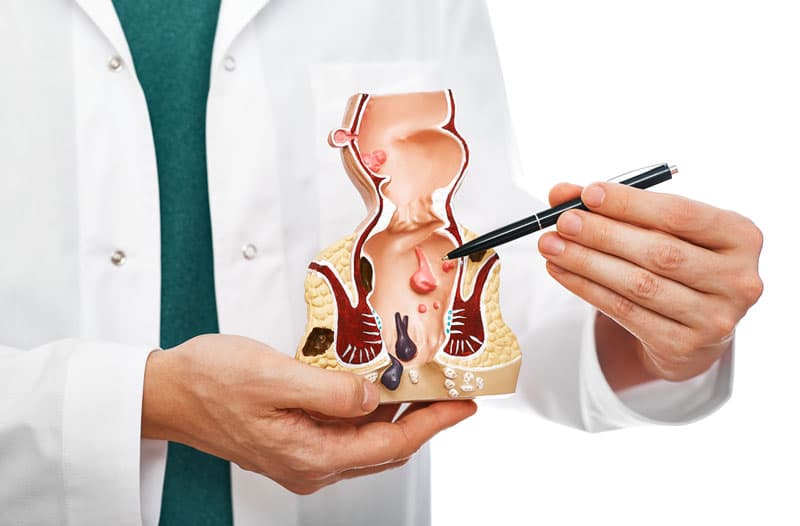 Khám trĩ ở đâu? 5 địa chỉ điều trị tốt nhất tại Hà Nội
