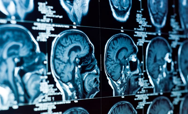Giá chụp MRI sọ não hiện tại là bao nhiêu?