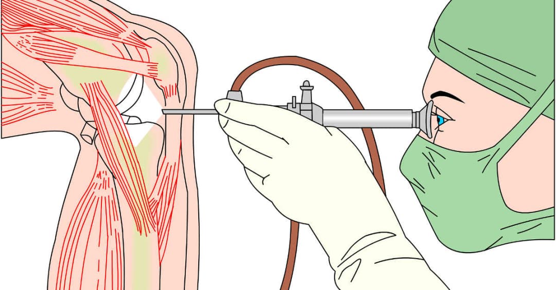 7 cơ sở y tế hàng đầu tại Hà Nội chuyên điều trị đau khớp gối