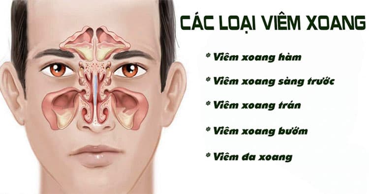 Chuyên gia hàng đầu điều trị viêm xoang tại Hà Nội