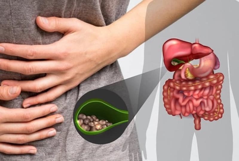 5 Bác Sĩ Chuyên Khám Chữa Sỏi Mật Hàng Đầu Tại Hà Nội
