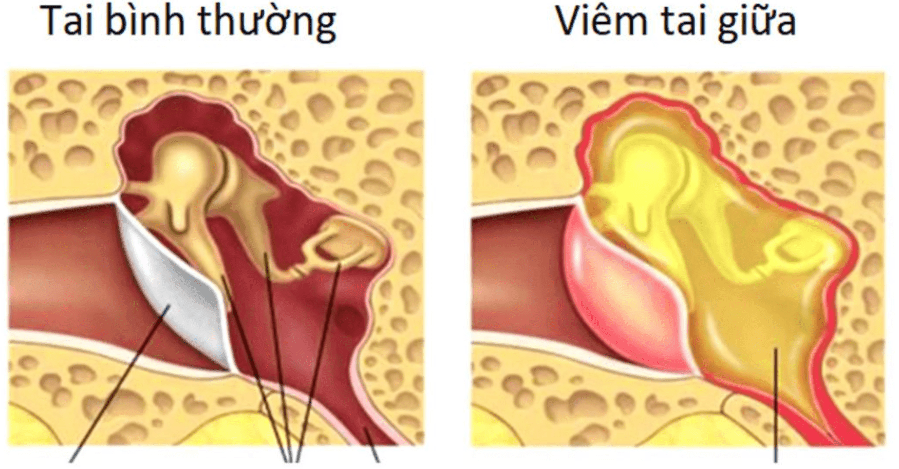 5 bác sĩ chuyên khám và điều trị viêm tai giữa xuất sắc tại TP.HCM