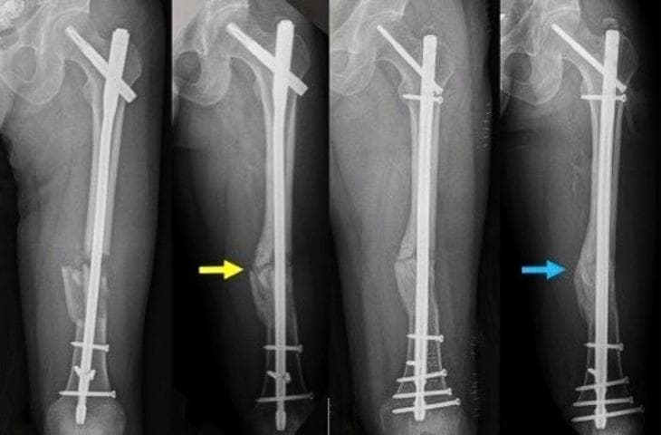 5 Bác sĩ Phẫu thuật Xương Khớp Xuất sắc Tại Hà Nội