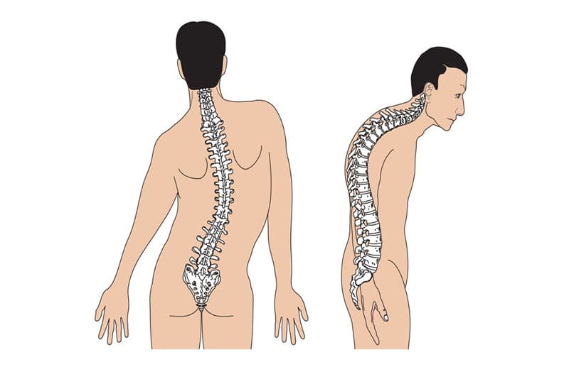 5 Địa chỉ Khám Chữa Cong Vẹo Cột Sống Hàng Đầu Tại TP.HCM