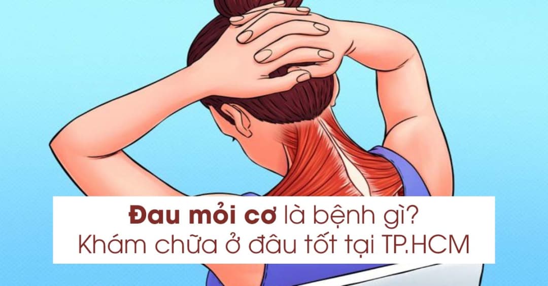 Đau mỏi cơ là gì? Địa chỉ khám chữa hiệu quả tại TP.HCM