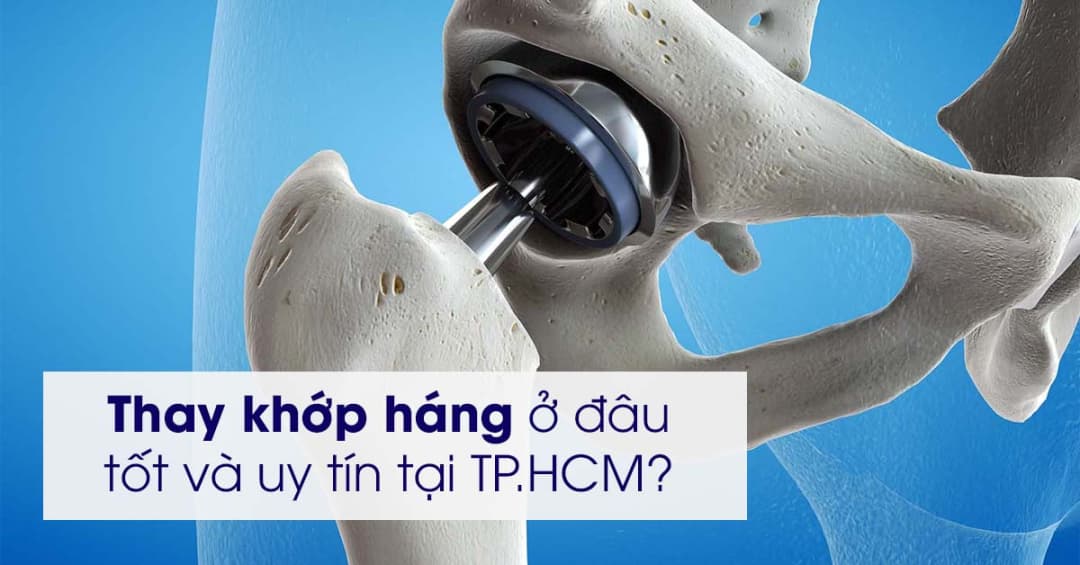 Địa chỉ thay khớp háng uy tín tại TP.HCM