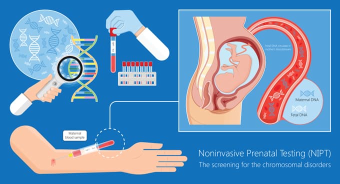 Khám Phá Các Gói Xét Nghiệm NIPT: So Sánh Tại Các Đơn Vị Y Tế