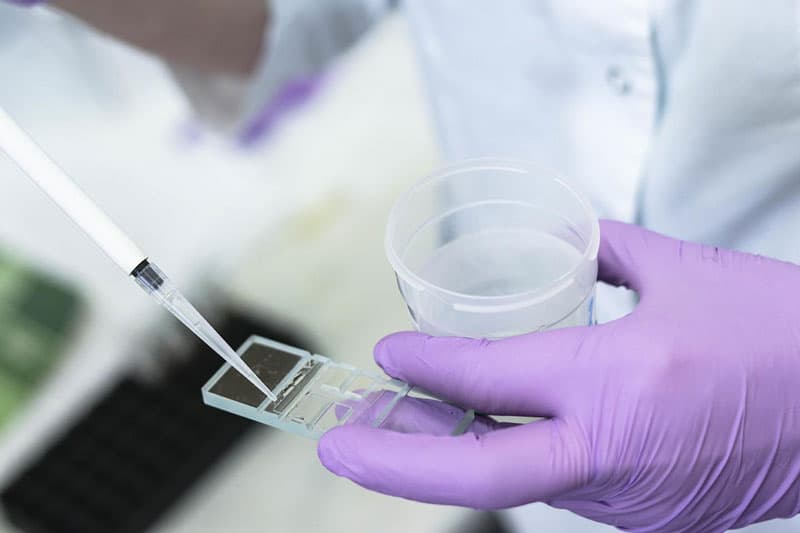 Bảng Giá Xét Nghiệm Tinh Trùng Tại 8 Địa Chỉ Đáng Tin Cậy Ở Hà Nội