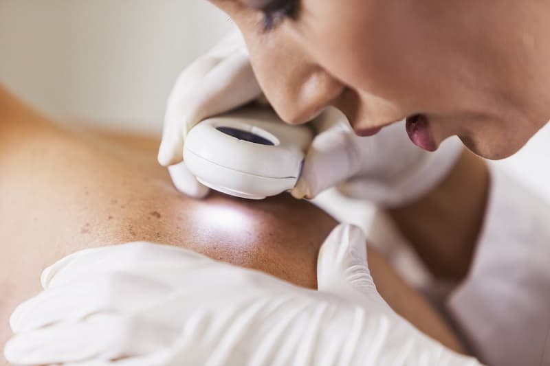 Top 5 Bệnh Viện và Phòng Khám Da Liễu Uy Tín tại Quận Hà Đông