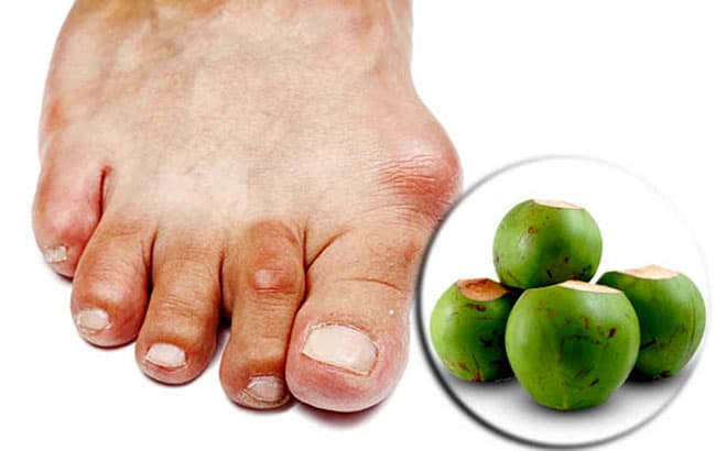 6 Bác sĩ Chữa Bệnh Gout Giỏi Tại Hà Nội