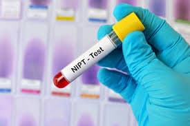 Xét nghiệm NIPT 7 phát hiện dị tật gì? Ai nên thực hiện NIPT 7?