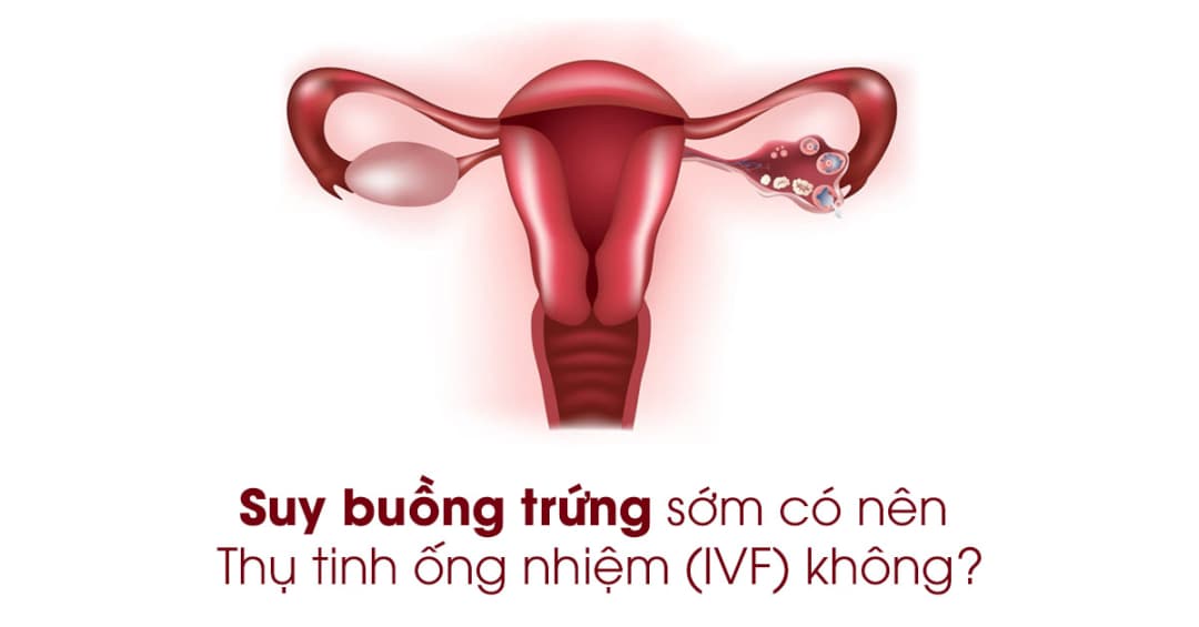 Suy buồng trứng sớm: Nguyên nhân và khả năng thực hiện IVF