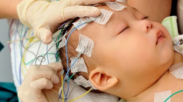 Bác sĩ chữa động kinh cho trẻ giỏi – Địa chỉ khám uy tín dành cho phụ huynh