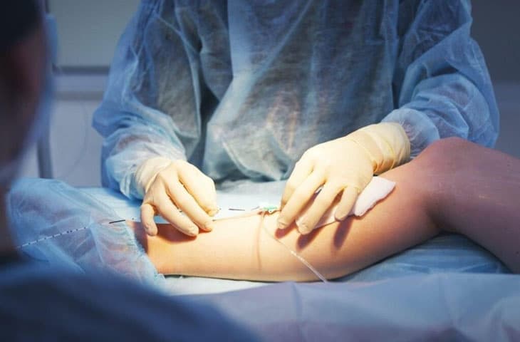 Chi phí điều trị giãn tĩnh mạch bằng sóng cao tần ở 5 phòng khám hàng đầu ở Hà Nội