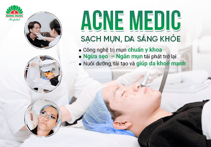 Gói Điều trị mụn tại Bệnh viện Hồng Ngọc