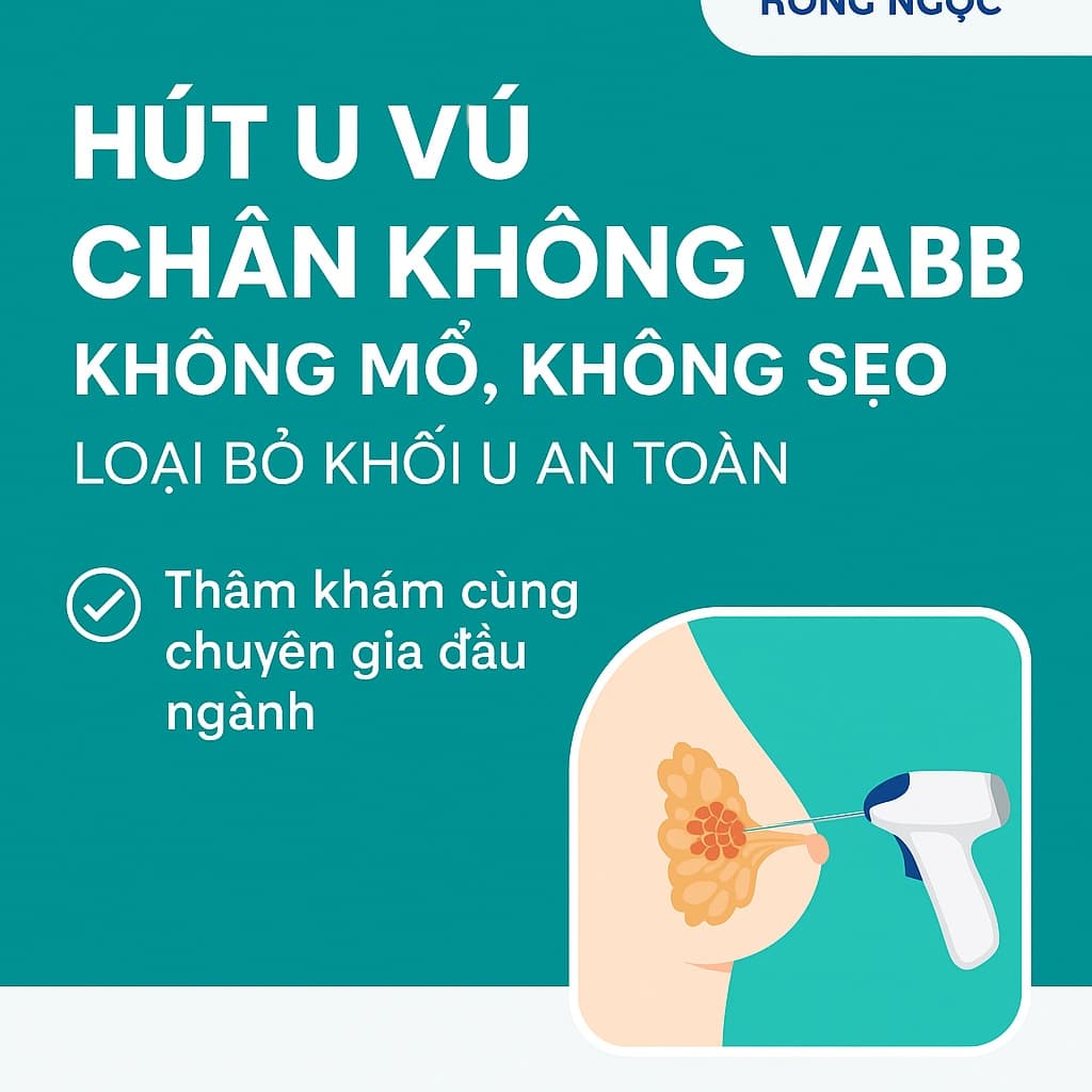 Hút u vú chân không VABB tại Hồng Ngọc: Không mổ, không sẹo, loại bỏ khối u an toàn
